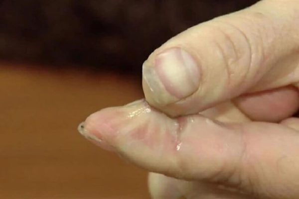 cách tẩy keo 502 dính vào tay